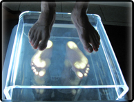 Jalkojen kuormitustutkimus