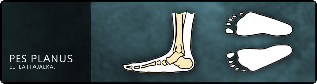 PesPlanus lattajalan tukipohjalliset